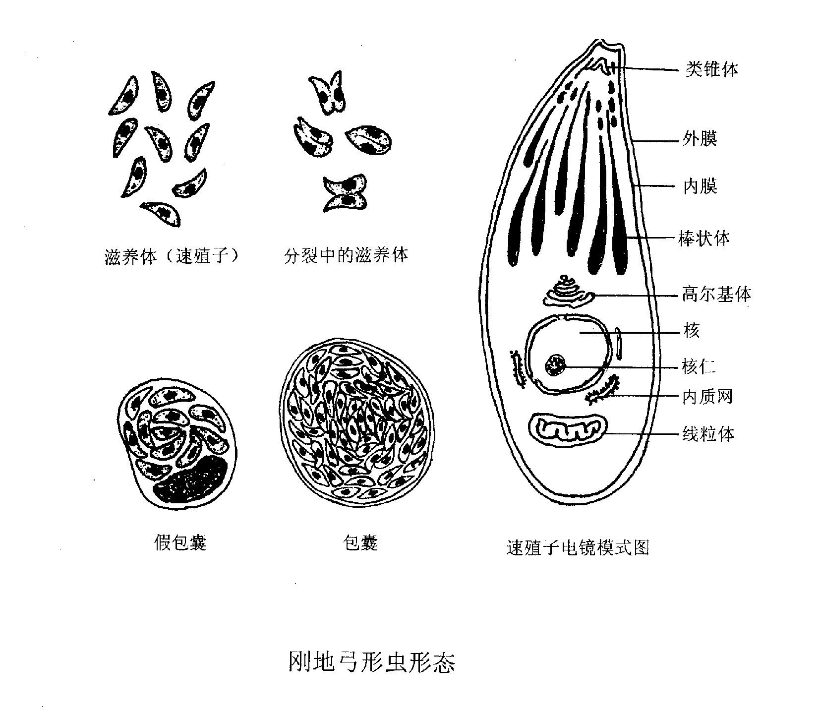 7楼回复pathology 弓形虫病(toxoplasmosis)由 刚地弓形虫