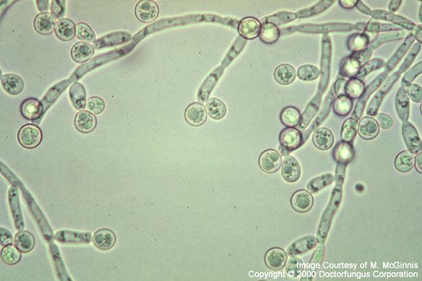 【资源】非常漂亮的厚膜孢子假菌丝