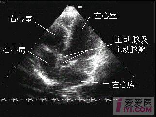 超声正常解剖与标准切面