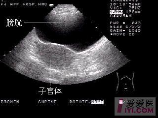 超声正常解剖与标准切面
