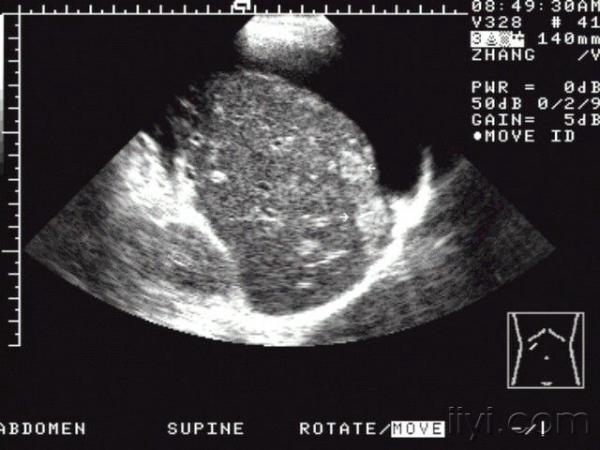 肝脏疾病声像图表现