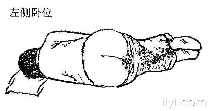 10楼回复便衣天使左侧卧位(示意图)