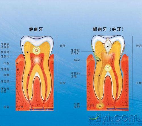 超清晰牙齿解剖图片