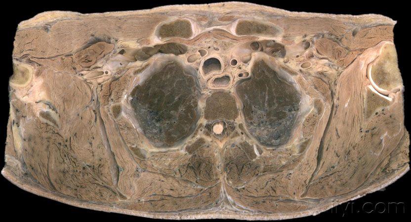 人体断层解剖真人标本图片