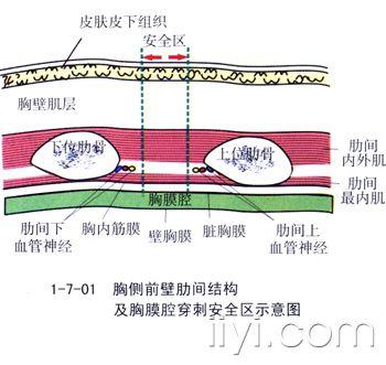 庞继光的 针刀入路示意图>