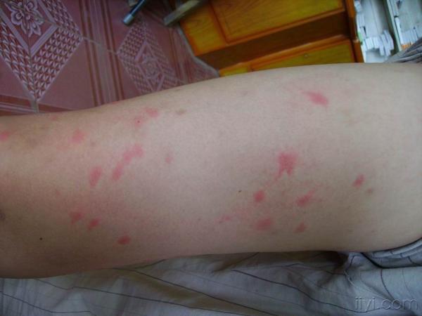 皮肤科摄影展的照片,愿意用做图谱的请把原图