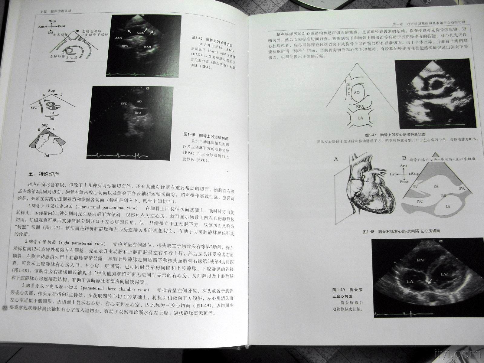 超声心动图标准切面,切法示意图 - 超声医学资源版 - 爱爱医医学论坛