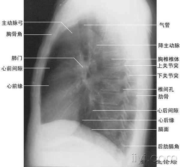 (经验)实习生如何读胸片