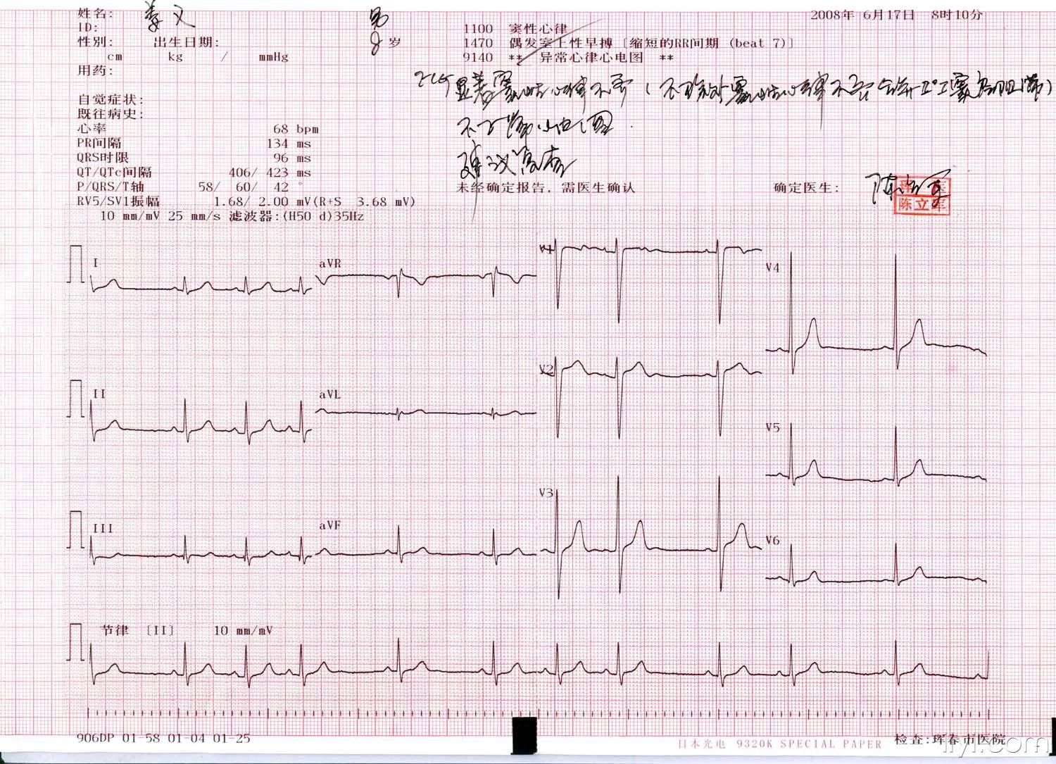 我孩子的心电图,大家帮忙分析一下,给个结论