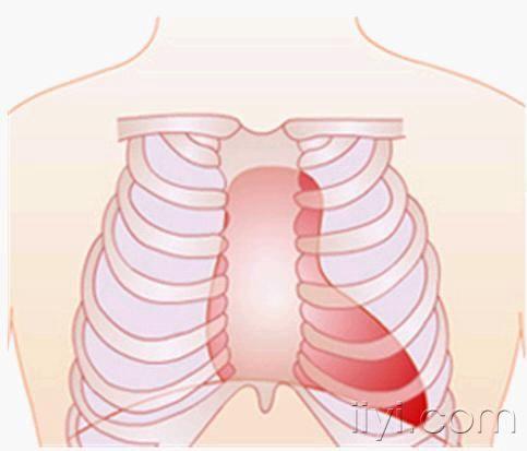 心脏形状发生改变的类型【经典】九月四日更新啦!