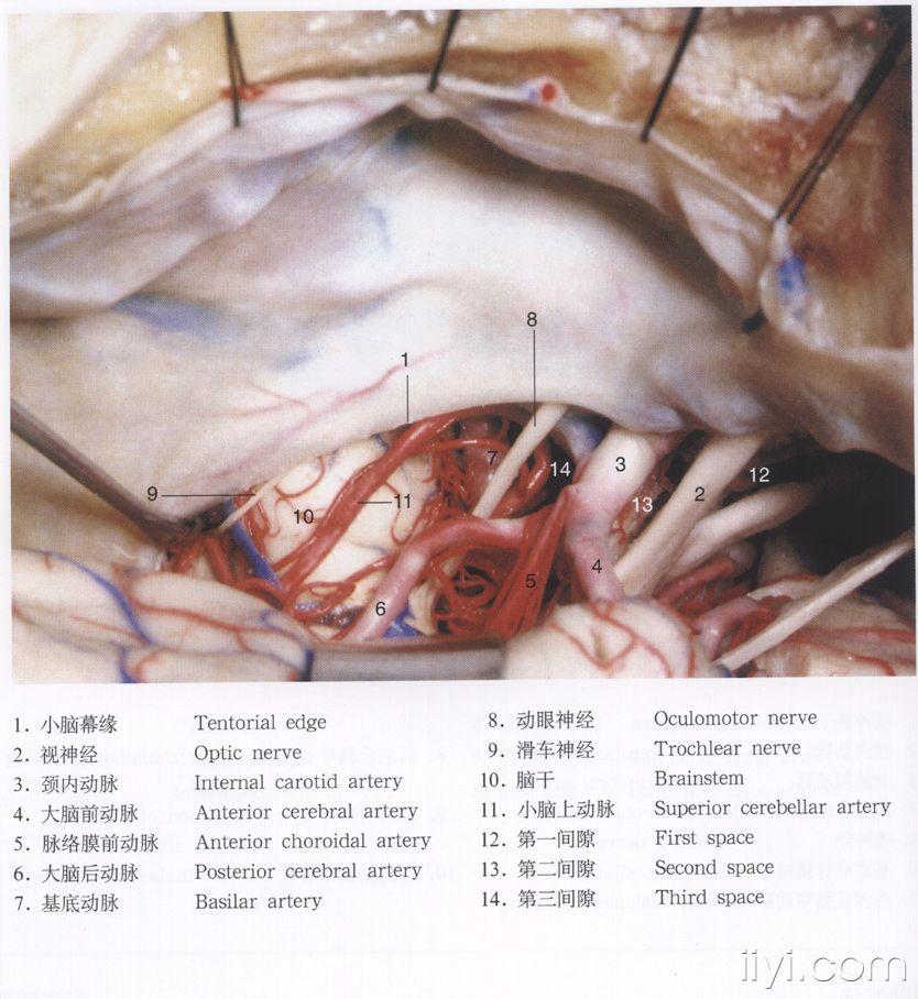脑解剖图片 - 神经外科资源版 - 爱爱医医学论坛 - 医
