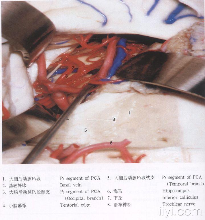 脑解剖图片 - 神经外科资源版 - 爱爱医医学论坛-爱爱