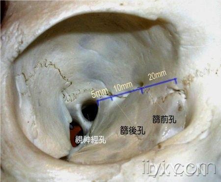 19楼回复let336212008-09-07 10:50:18筛前孔,筛后孔和视神经孔的