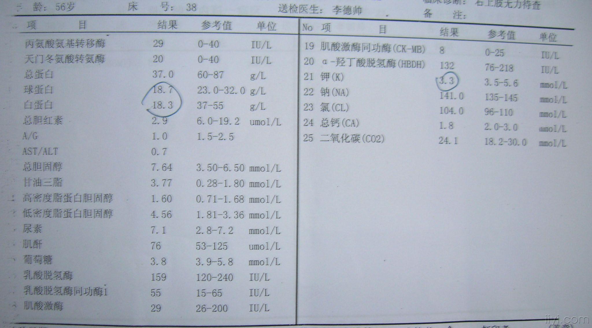 突发右手无力7天