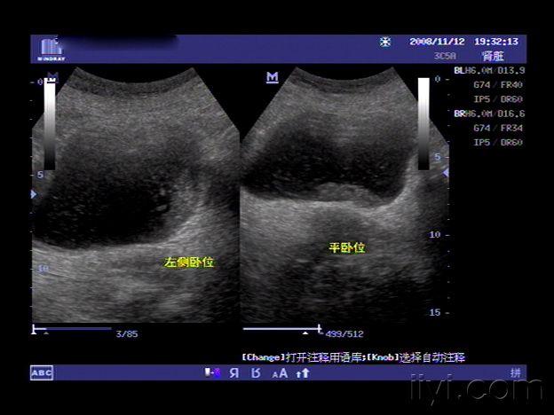 女性前列腺病 超声医学讨论版 爱爱医医学论坛-爱爱医医学网