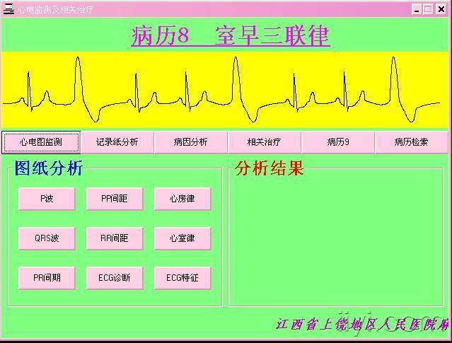 心电监测及相关治疗教学软件