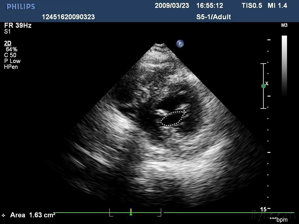 超声医学讨论版 - 爱爱医医学