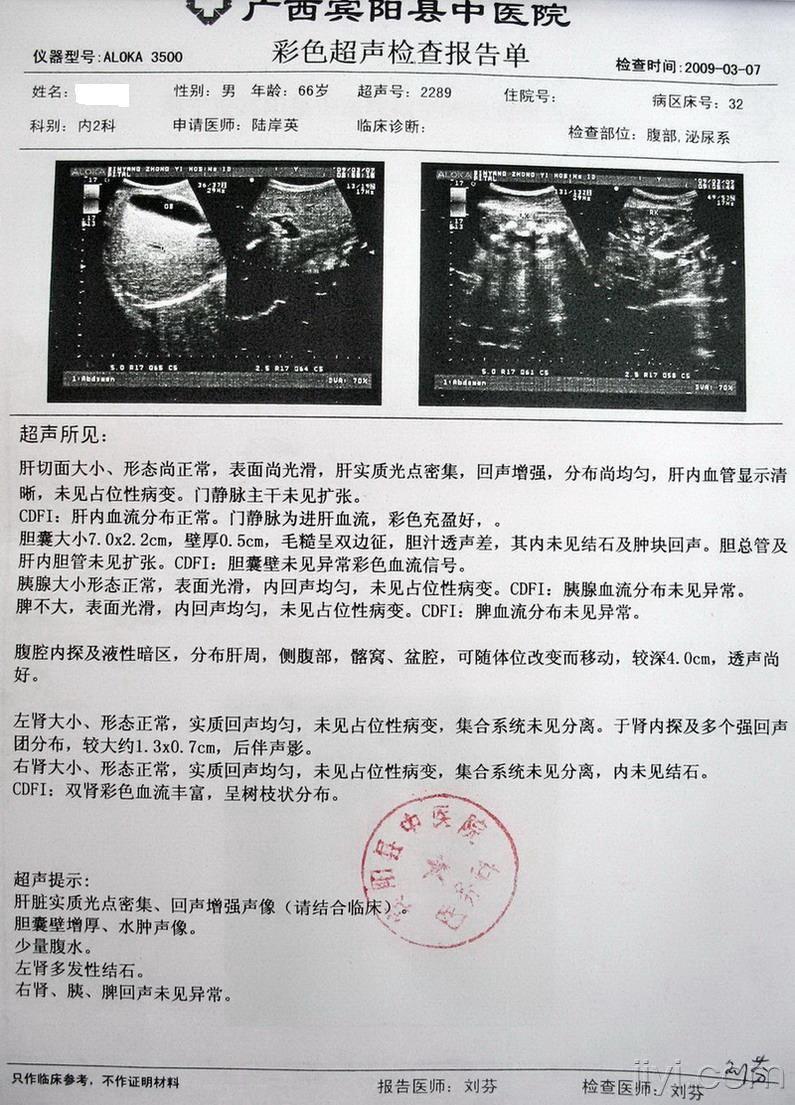 这个病例可以诊断为肝硬化(失代偿期)吗?
