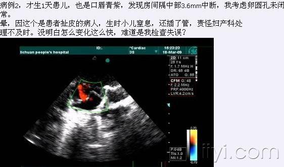 沙发    陈实我考虑卵圆孔未闭或室缺病例,上级医院检查正常.