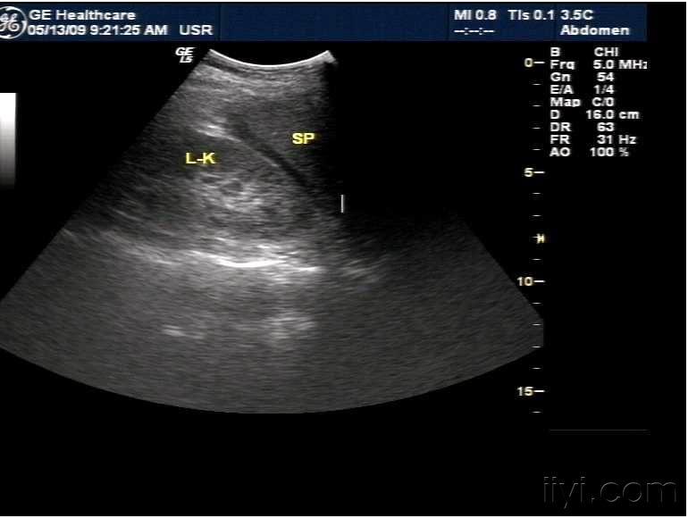 超声医学讨论版 - 爱爱医医学论坛 - 爱爱医医学网