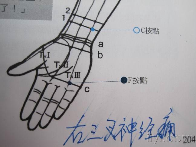 我整理出来的柯氏远络治疗图片