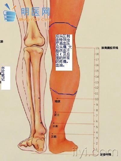 董氏奇穴十大放血区图