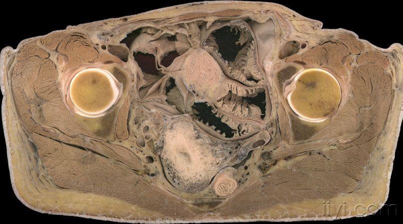 从头到下腹的断层解剖图片