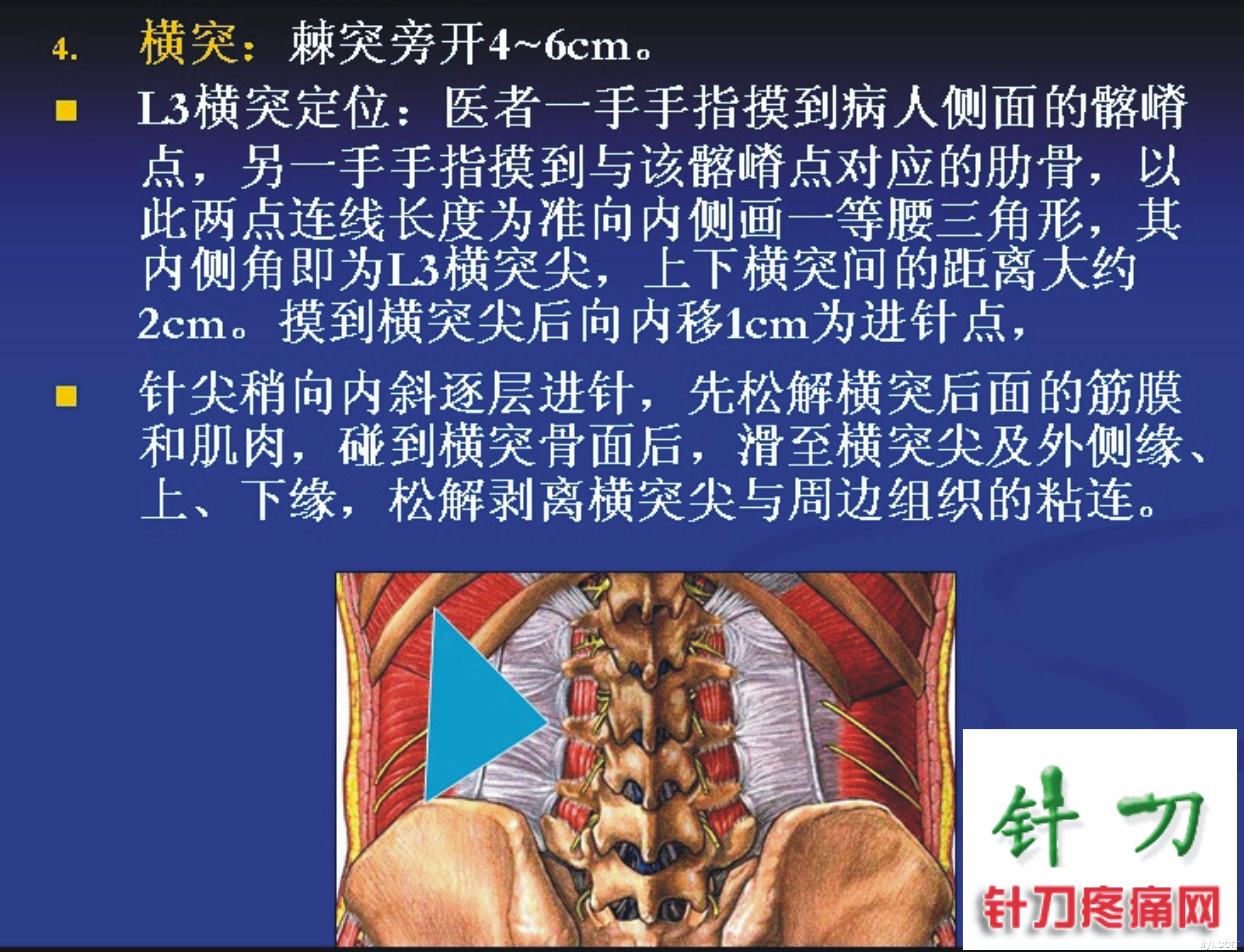 腰骶臀髋针刀辨位诊治新思路