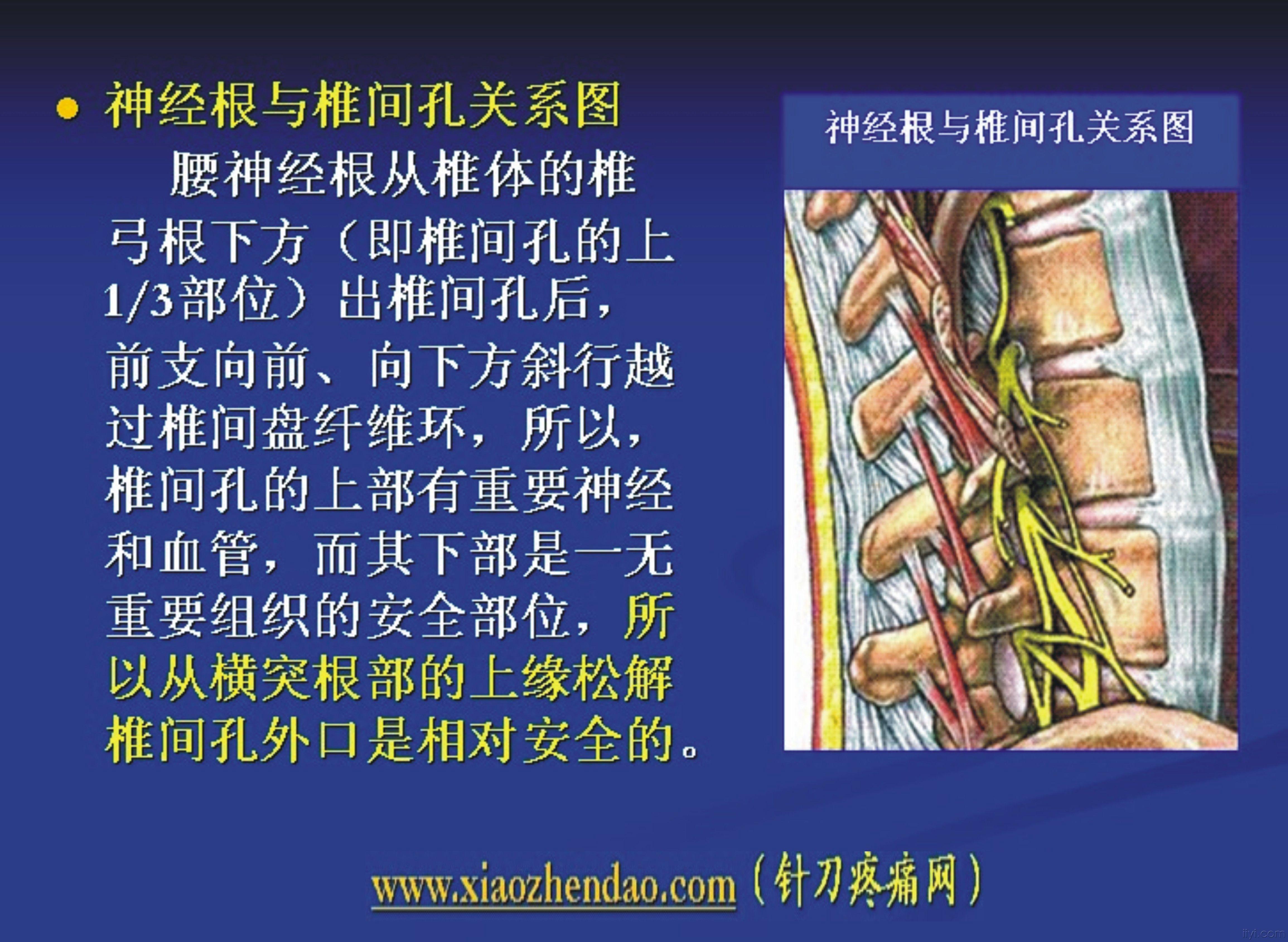 腰骶臀髋针刀辨位诊治新思路