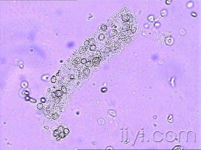 尿液细胞形态学 (经典)相差显微镜
