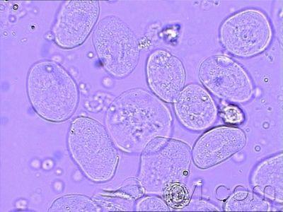 尿液细胞形态学 (经典)相差显微镜
