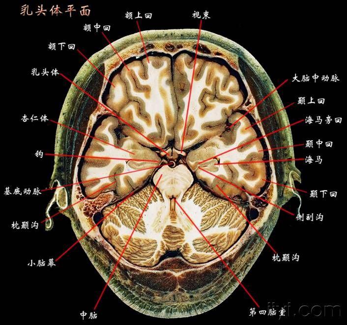 大脑断层解剖图谱2 - 神经内科资源版 - 爱爱医医学论坛-爱爱医医学网