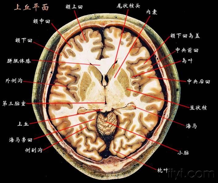 大脑断层解剖图谱2