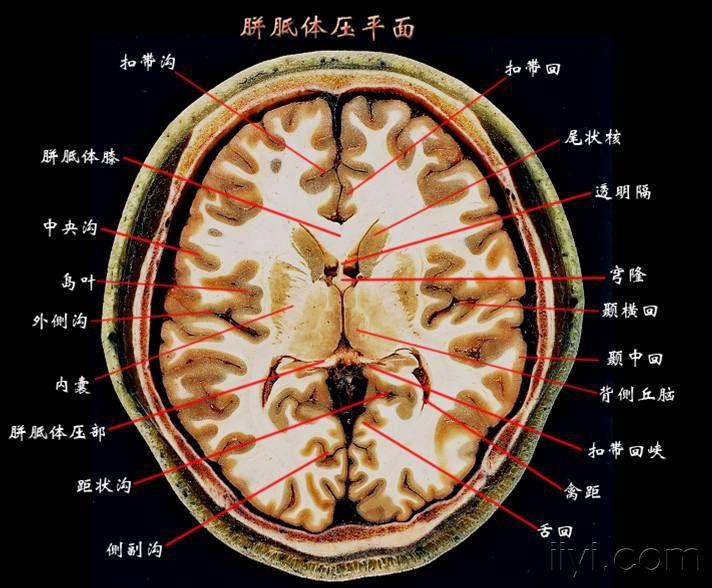 大脑断层解剖图谱2