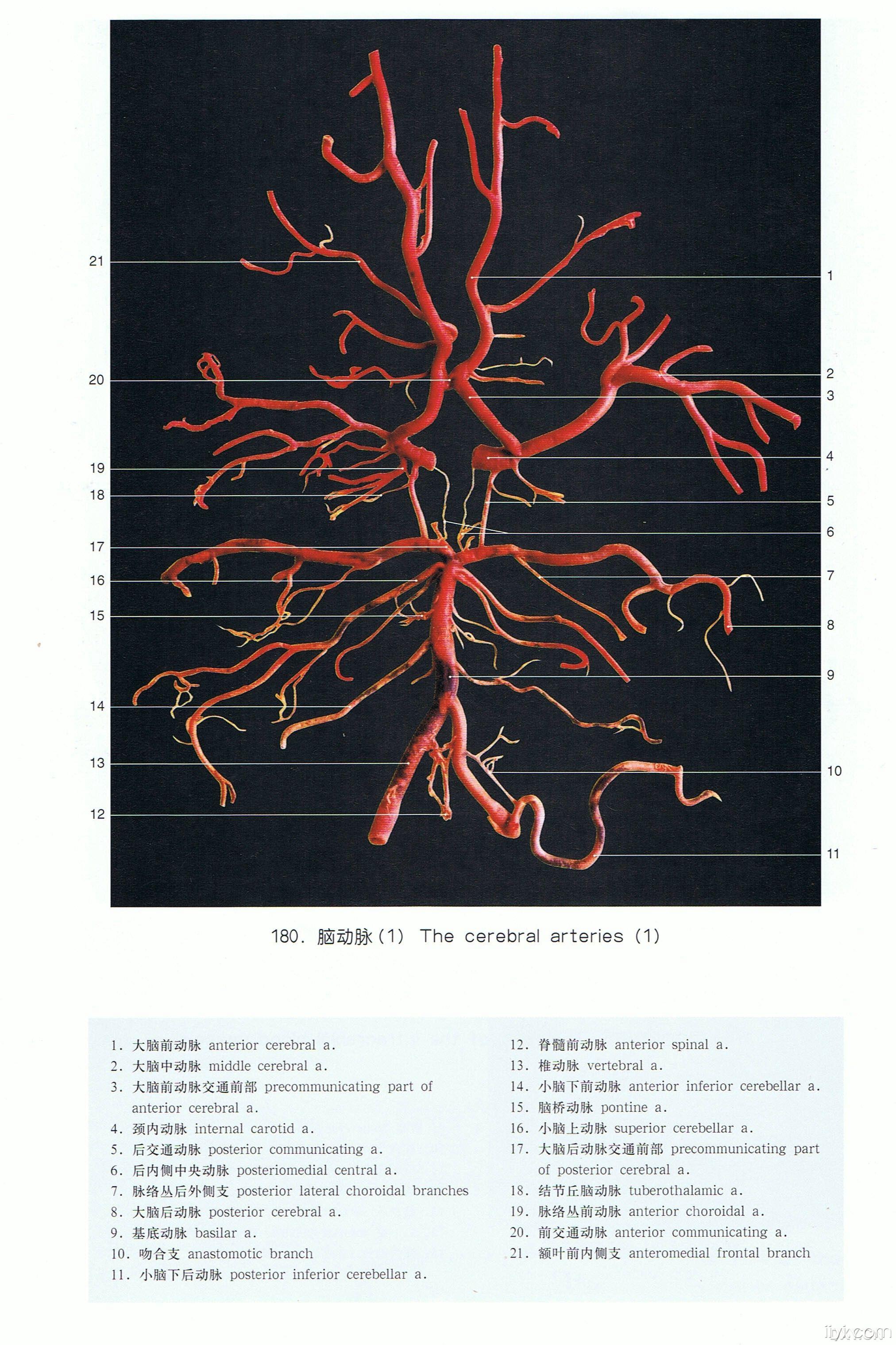 脑血管图