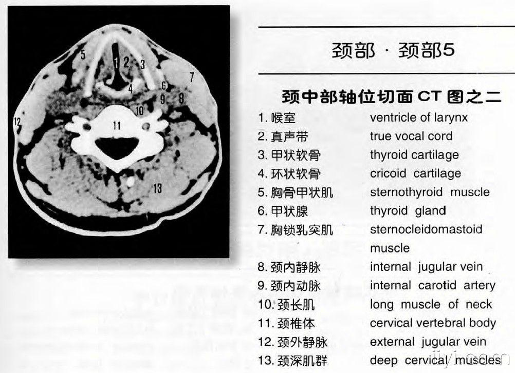 颈部ct解剖图谱jpg格式(申请加精)