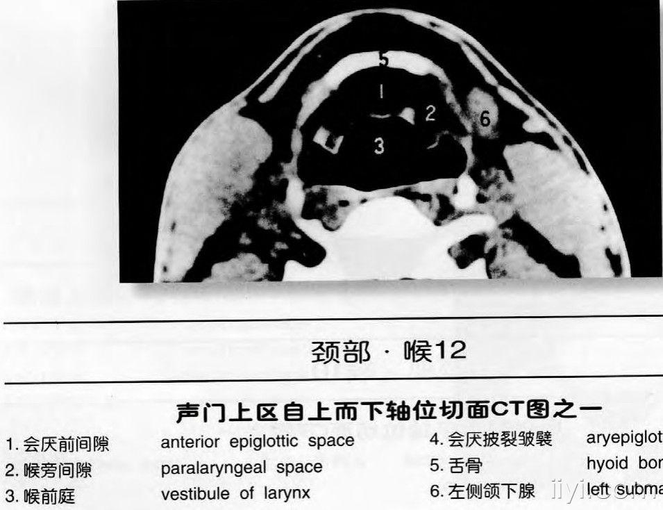 颈部ct解剖图谱jpg格式(申请加精)