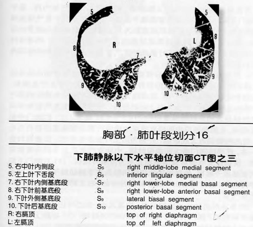 肺叶,段划分 医学影像学资源版 爱爱医医学论坛-爱爱医医学网