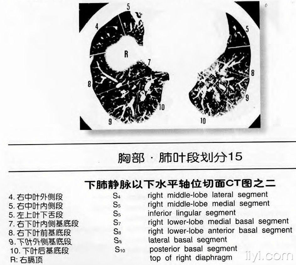 肺叶,段划分 医学影像学资源版 爱爱医医学论坛-爱爱医医学网