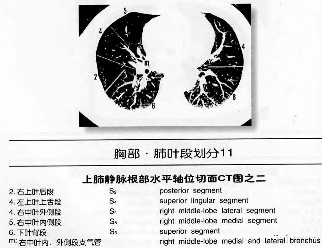 肺叶,段划分 - 医学影像学资源版 - 爱爱医医学论坛-爱爱医医学网