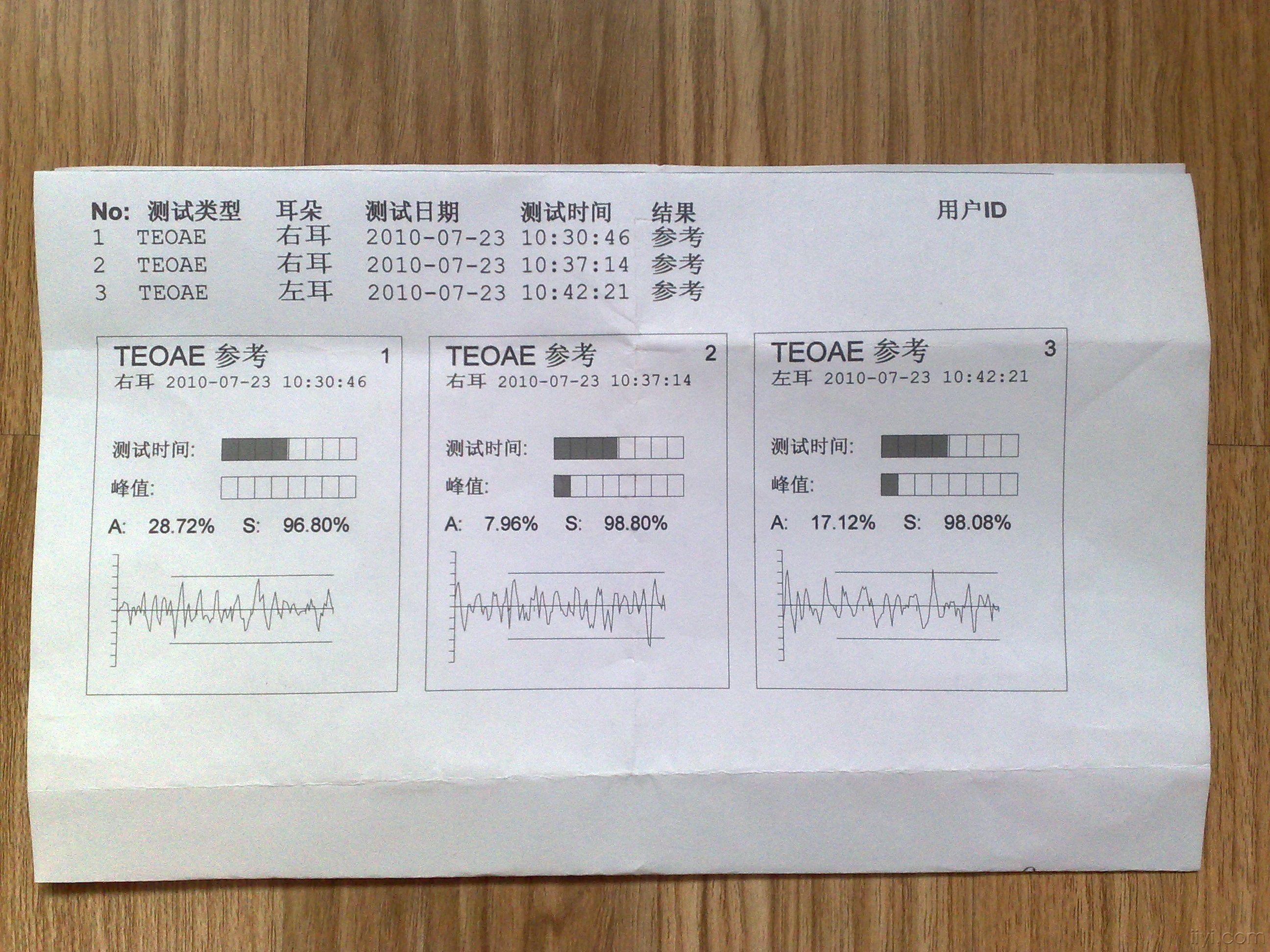 16:31:59我家宝宝刚生下来三天的时候去做听力测试,右耳没有通过,56天