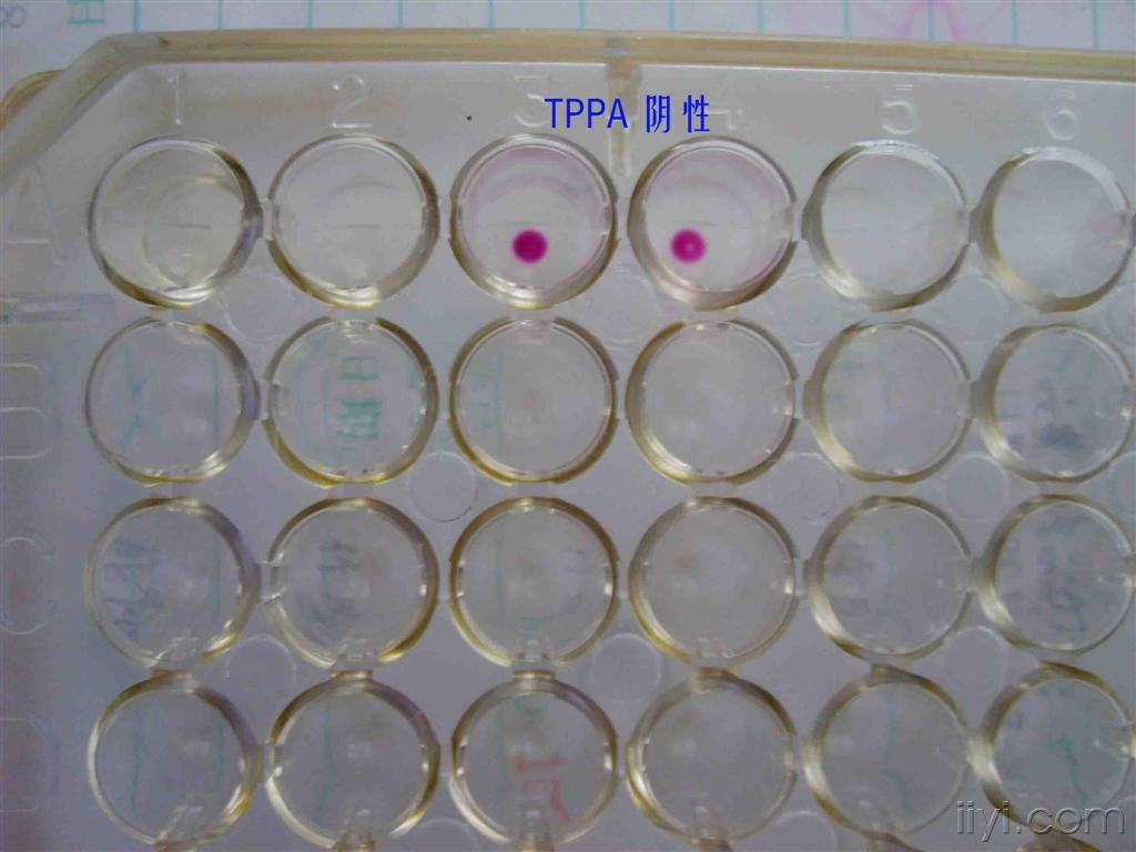 tppa阳性和阴性对照-应大家要求附带文字解释