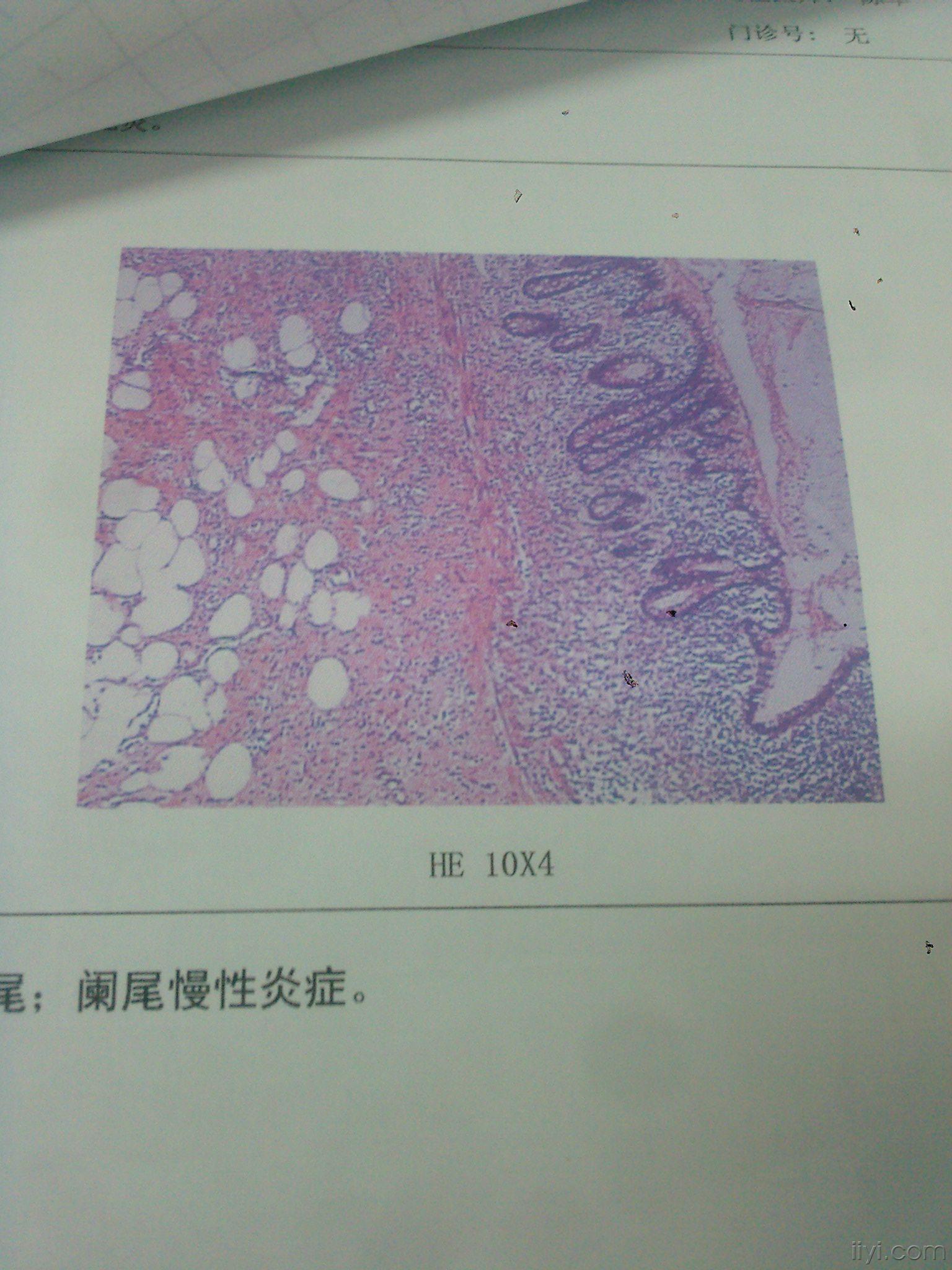 阑尾3(有病理) - 超声医学资源版 - 爱爱医医学论坛