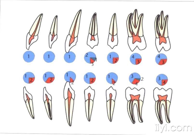 0口腔中牙常见的根管数目