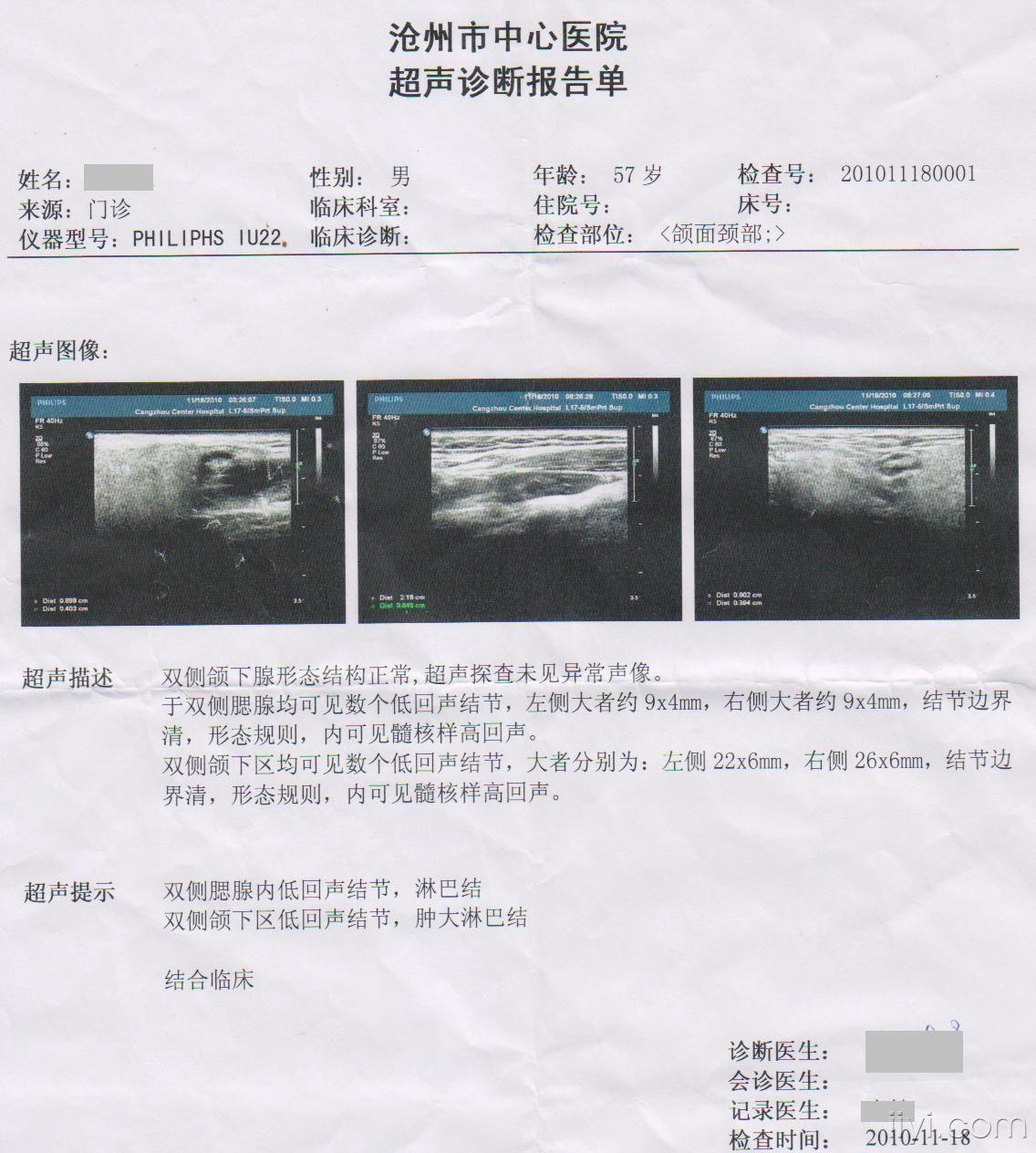 腮腺肿大是谁惹的祸?(患者第3次发病结果见13楼)