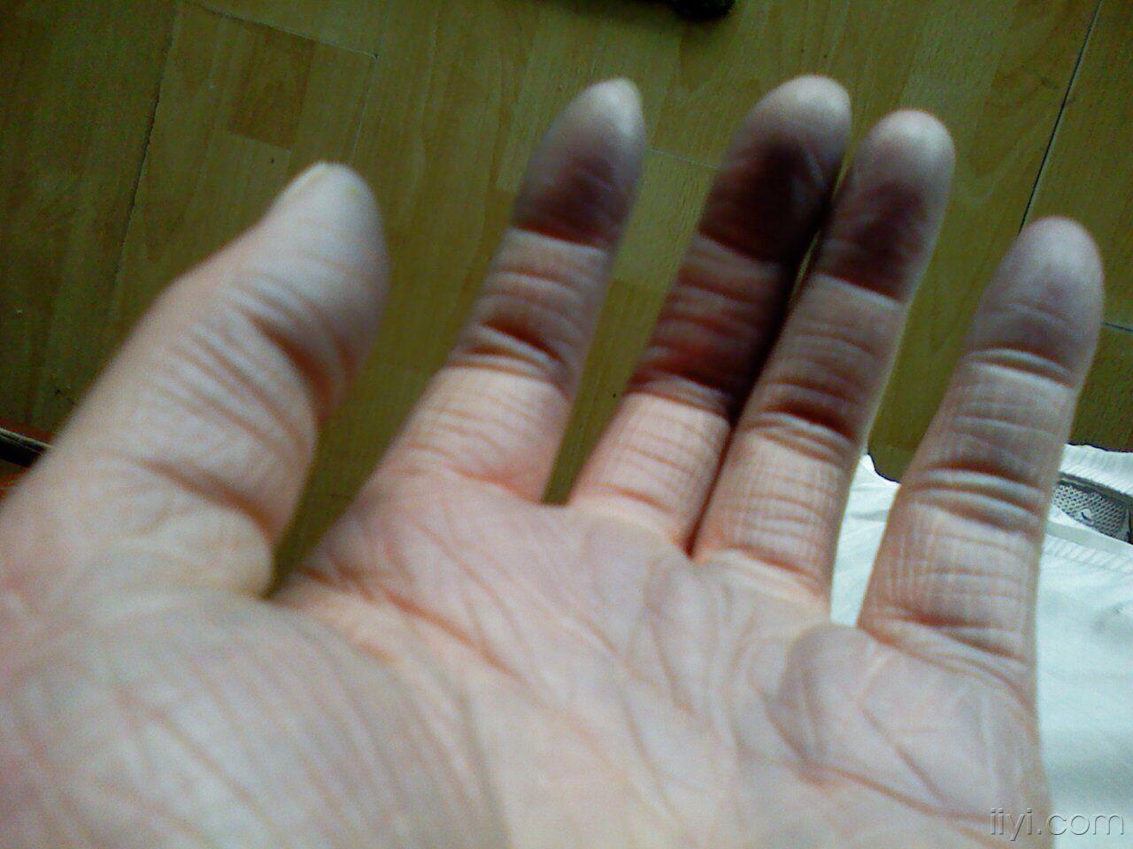 楼主趟大流2011-02-08 19:46:25天气一冷我的手就变黑,相片附上  这