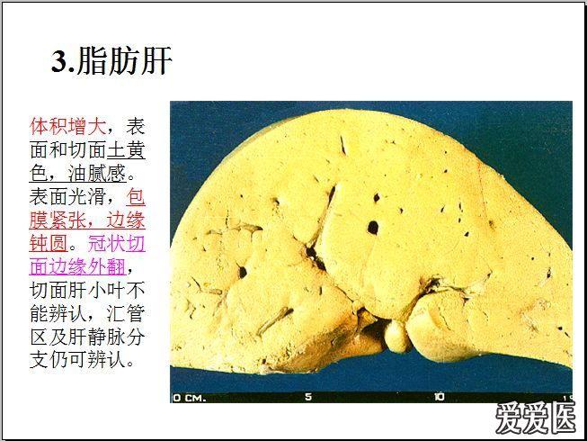 病理实验复习整理(大体 切片)