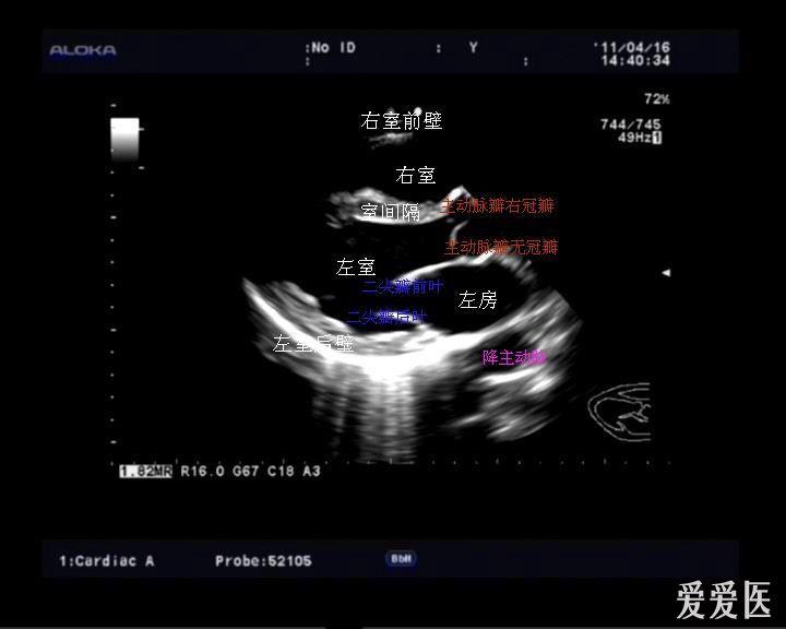 复习常用心脏切面