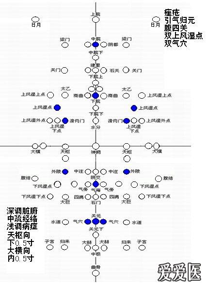 腹针处方图示