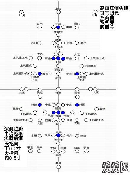 腹针处方图示